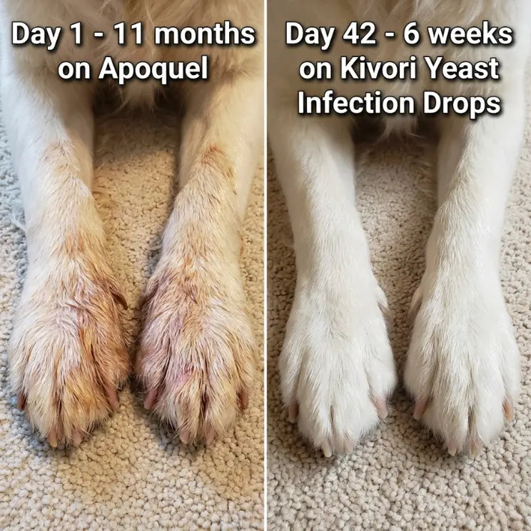 Kivori Yeast Infection Drops™ Kivori